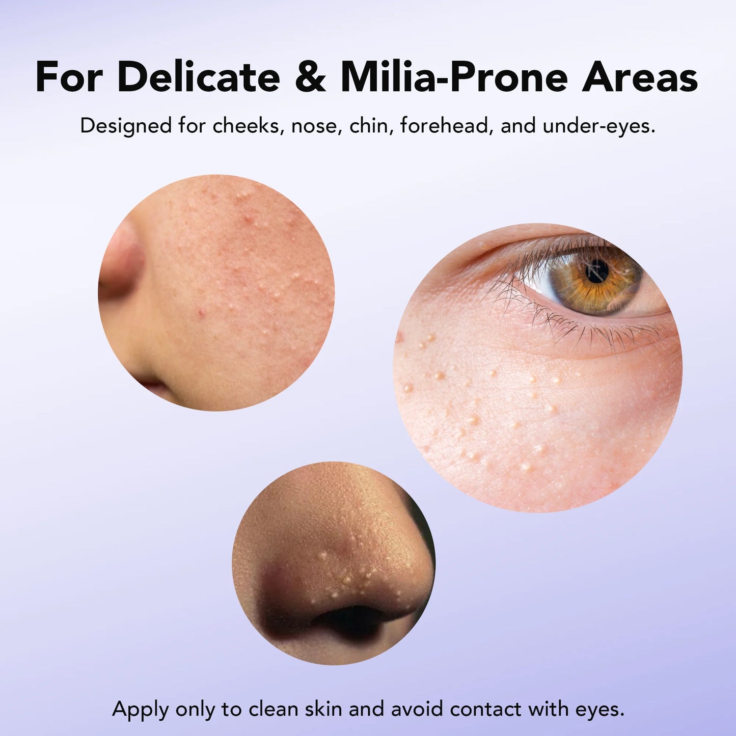 Dermea™ Milia Clear Serum