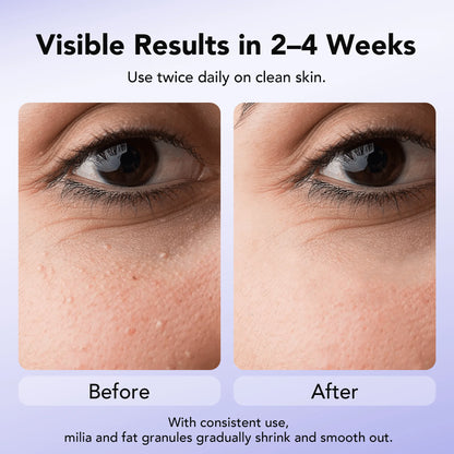 Dermea™ Milia Clear Serum