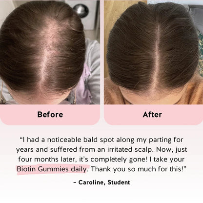 Beauty Bears™ | Because You Deserve a Second Chance to Shine.