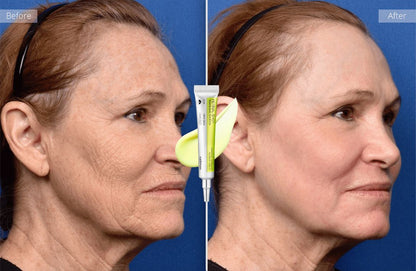 Vita A Retinal Tightening Booster™ | Selling Out Fast!