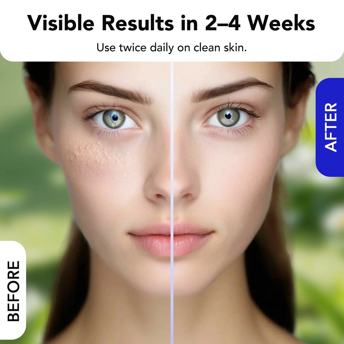 Dermea™ Milia Clear Serum